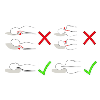 Cách chọn gối ngủ cho người đau cổ Cách chọn gối ngủ cho người đau cổ